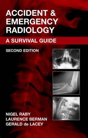 Accident and Emergency Radiology: A Survival Guide