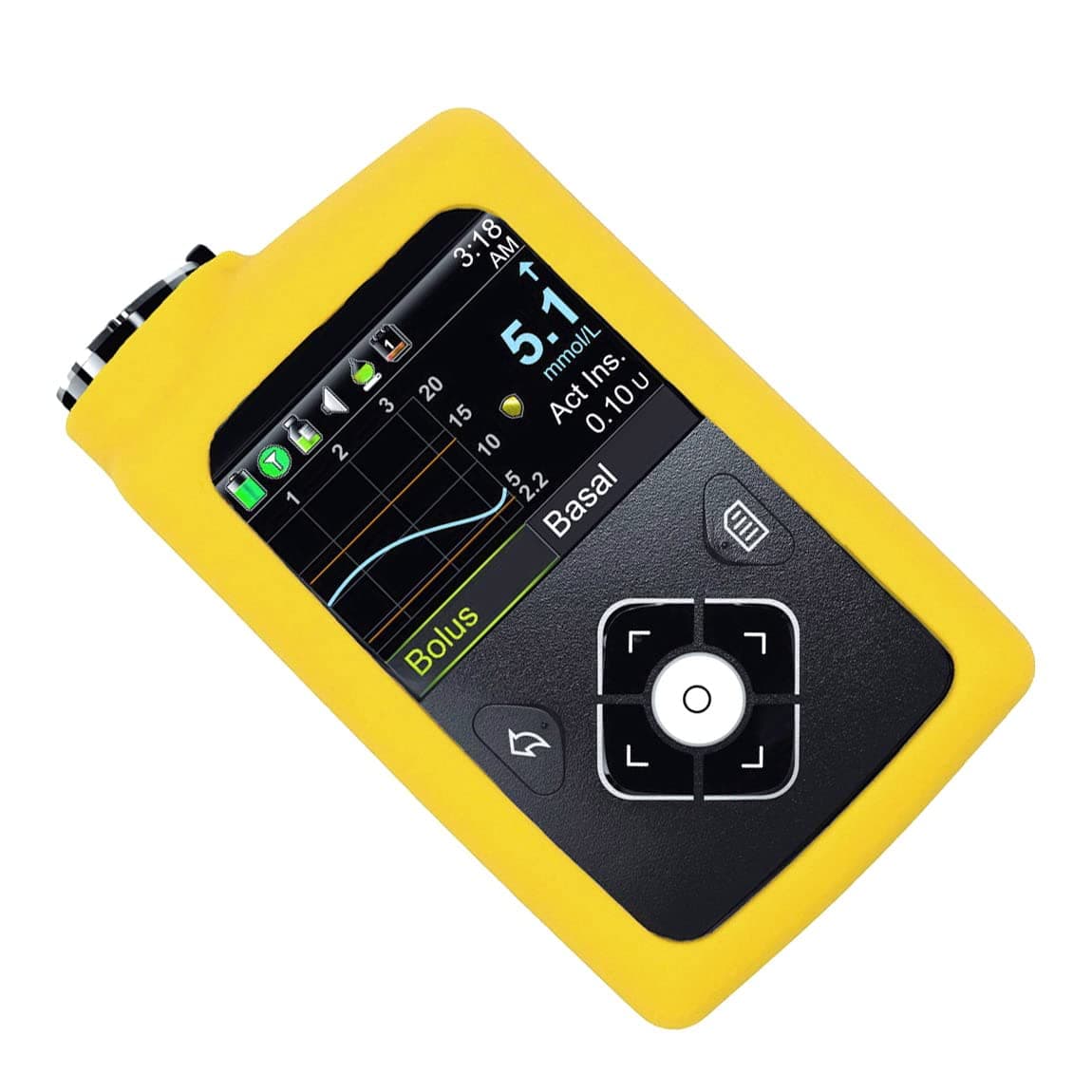 Solid Color Premium Silicone Soft Case for Medtronic Minimed Insulin Pump 630G/ 640G/ 670G/770G/780G (Yellow)