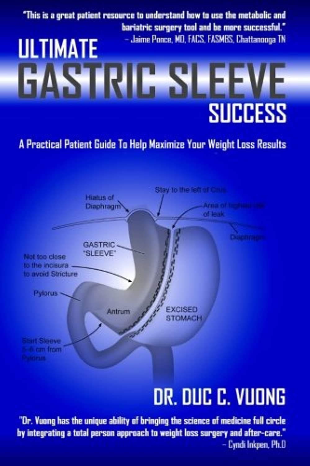 Ultimate Gastric Sleeve Success: A Practical Patient Guide To Help Maximize Your Weight Loss Results Paperback – 21 June 2013